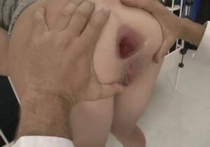 Anal Extreme Gaping Bowflex Xtreme - Anal Extreme Gaping Bowflex Xtreme | Sex Pictures Pass