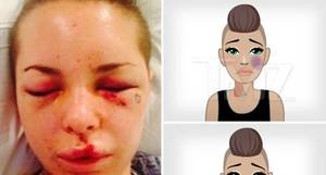Bruises Porn - Porn Star Christy Mack -- Creates Domestic Violence Emojis ... Black Eyes,  Bruises (PHOTOS)