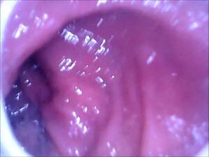 internal anal camera - Vore Mouth Tours: Endoscope camera inside my ass - ThisVid.com