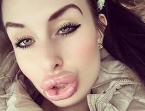 Duck Lips Porn - Enormous 'porn star lips' on show in terrifying gallery of selfies | The Sun