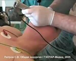 Intubation Porn - Search - intubation | MOTHERLESS.COM â„¢