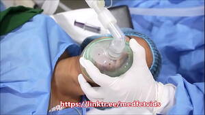 Intubation Porn - Girl gets gassed and intubated Porn Video - Rexxx