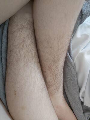 Natalie Portman Hairy Pussy - I got hospitalized yesterday, while I was unconscious at the bed, the  doctor decided to tell my mom \