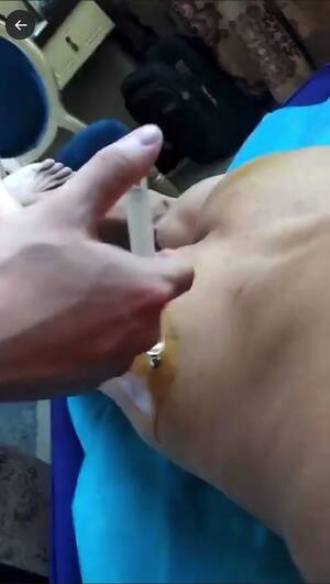 needle injection - Injection with glass syringe and very long needle - ThisVid.com