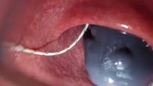 Colonoscopy Porn - Colonoscopy Porn Videos (2) - FAPCAT