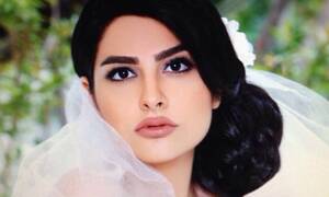 Iranian Porn Stars - Modelling Iranian style': surgical alterations and the 'porn star' look |  Iran | The Guardian