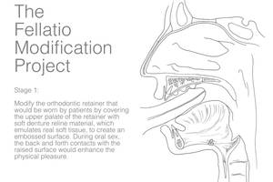 fellatio black - A medical drawing of the sex prosthetic with text that reads \