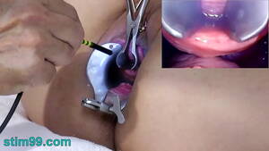 dark latina piss hole - Female Endoscope Camera in Pee Hole with Semen and Sounding with Dildo -  XVIDEOS.COM