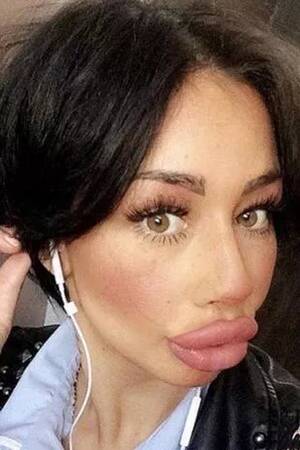 Big Lips Porn Stars - Terrifying pictures show worrying trend of 'porn star lip fillers' - Mirror  Online