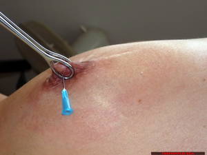 needle bdsm - 