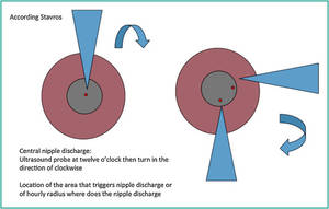 Nipple Discharge Porn - the How Many Cases Of Sexual Harassment Are Reported Each Year you take