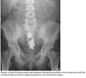 M M - Things stuck in butts then x-rayed . mm see through porn