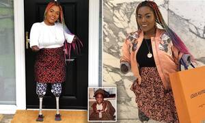 Forced Quadruple Amputee Porn - Quadruple amputee fashion influencer Hannah Oletaju says she wants to  inspire others | Daily Mail Online