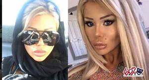 Iran Porn Star Nose Job - Porn star risks death sentence by going to Iran for nose job - The Malta  Independent