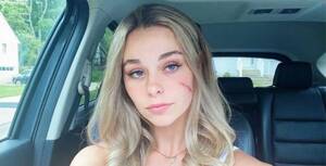 Fucking Blonde Girls Do Porn - Everything the TikTok 'scar girl' has said about her facial scar