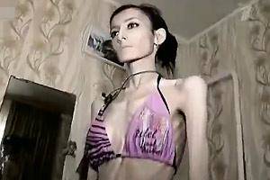 Anorexic Girl Anal Sex - Anorexic Girl Starving Herself