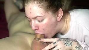 Acne Porn - Free Acne Porn Videos - Free HD Porn - GoFucker.Net