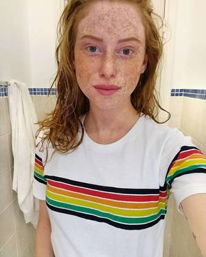 Freckles Porn Captions - Face full of freckles #redheadgirls #redheads #sexyteens #redheadteens  #raylene #porn