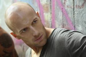 Alopecia Porn - If you are one of the unlucky fellows who is becoming â€œfollicly challengedâ€  over time, you don't have to sit back and helplessly watch your hair fall  out.