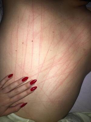 Clawing Back Girl Porn - How do you feel about back scratching during sex? - Sexuality