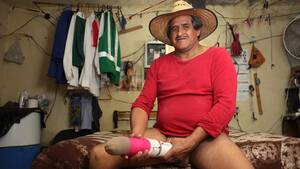 longest dick ever - Who is Roberto Esquivel Cabrera and does he have the biggest penis in the  world? â€“ The Sun | The Sun