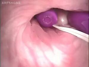 camera inside vagina during sex - Endoscope: Japanese Camera inside Vagina - ThisVid.com