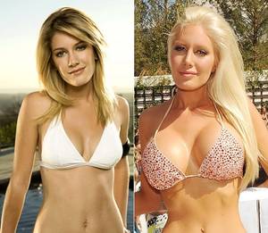 Best Before And After Porn - Heidi Montag : Plastic Surgery Gone Wrong... How many Women AND Men alike