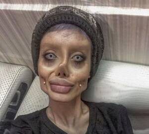Angelina Jolie Rough Porn - 19 year-old has 50 surgeries look like Angelina Jolie, looks more like a  walking corpse : r/WTF
