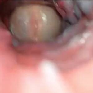 inside asshole - View from the inside of the ass - ThisVid.com