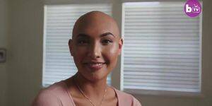 Alopecia Porn - elegance of alopecia - Tnaflix.com