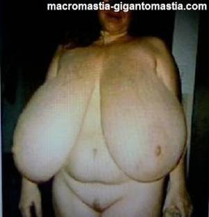 gigantomastia breasts - 19 best Gigantomastia images on Pinterest | Boobs, Big black and Big  naturals