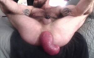 anal prolapse galleries - PROLAPSE GALLERY #1 - HungerFF.com