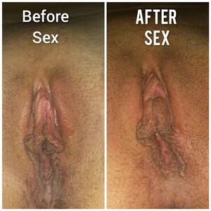 Before And After Fuck - Pussy comparison before and after the sex Porn Pic - EPORNER