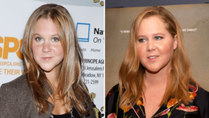 Amy Schumer Blowjob - Did Amy Schumer Get Plastic Surgery? Transformation Photos