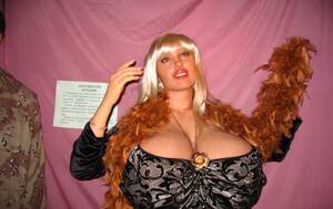 Beshine Porn - Fotos: Personas reales que terminaron espantosamente mal por cirugÃ­as  plÃ¡sticas â€“ Publimetro Colombia