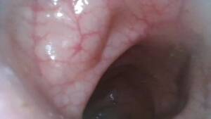 colon cam - The Colonoscopy. the Rough Intestine Research of the Bowel - Pornhub.com