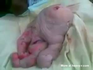 Disfigured Porn Asshole - Deformed Newborn