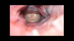 inside asshole - Inside view of an asshole fucking - ThisVid.com