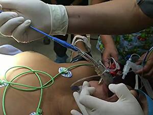 Intubation Porn - Endotracheal intubation woman | MOTHERLESS.COM â„¢