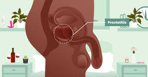 Anime Porn Hittng Prostate - Prostate Play 101: How to Massage Your Prostate Gland