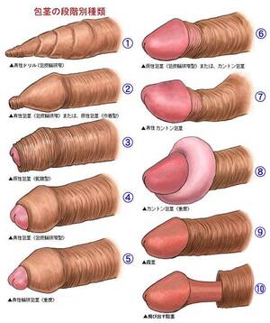 Japanese Foreskin Porn - Japanese Foreskin Chart - Wait, what? [NSFW] : r/WTF