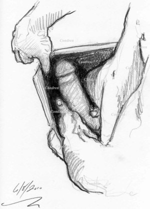 Big Dick Porn Pencil Drawings - Penis Drawings With Prints And Scans â€¢ Condren Galleries