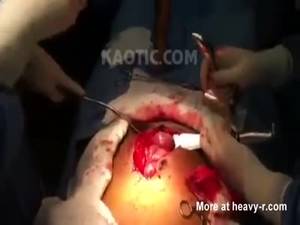 Japanese Bestiality - Electric Eel Surgically Removed From Man's Ass