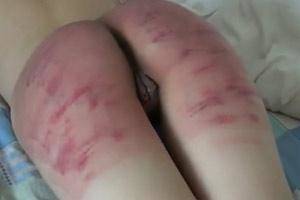 belt whipping girl bdsm bruises - Whipped Ass