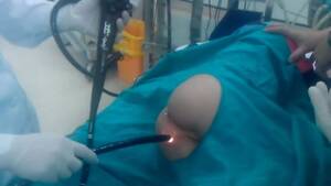 Colonoscopy Porn - Colonoscopy exam training(young) - ThisVid.com