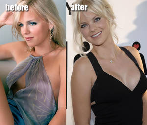 Anna Faris Pussy Hairy - Anna Faris Plastic Surgery Before and After. Celebrity plastic surgery gone  wrong is like a fleshy train-wreck, but Anna Faris definitely got it right.