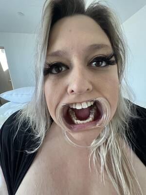 Freak Mouth Porn - Mouth retractor freak : r/humiliatedhoes