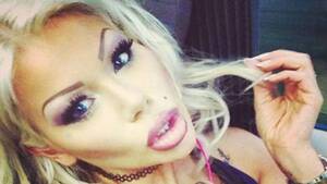 Iran Porn Star Nose Job - Much ado about nose job? Brit porn star's trip to Iran for rhinoplasty  sparks outcry in Islamic Republic - India Today