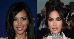 Best Before And After Porn - Kim Kardashian Before And After: Plastic Surgery Timeline