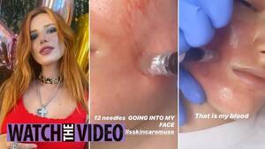 Bella Thorne Naked Lesbian - Bella Thorne left with bloodied face after skincare treatment to remove  acne â€“ The US Sun | The US Sun